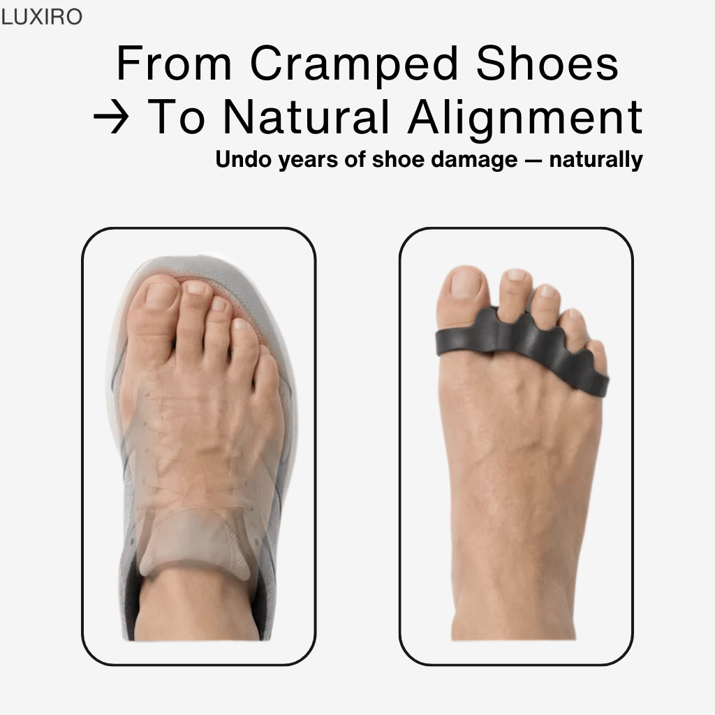 Finally, Relief for Bunion Pain—Without Surgery