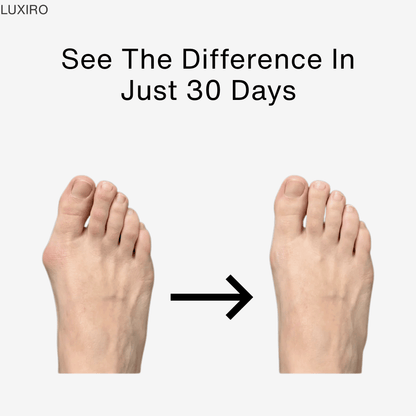 Finally, Relief for Bunion Pain—Without Surgery
